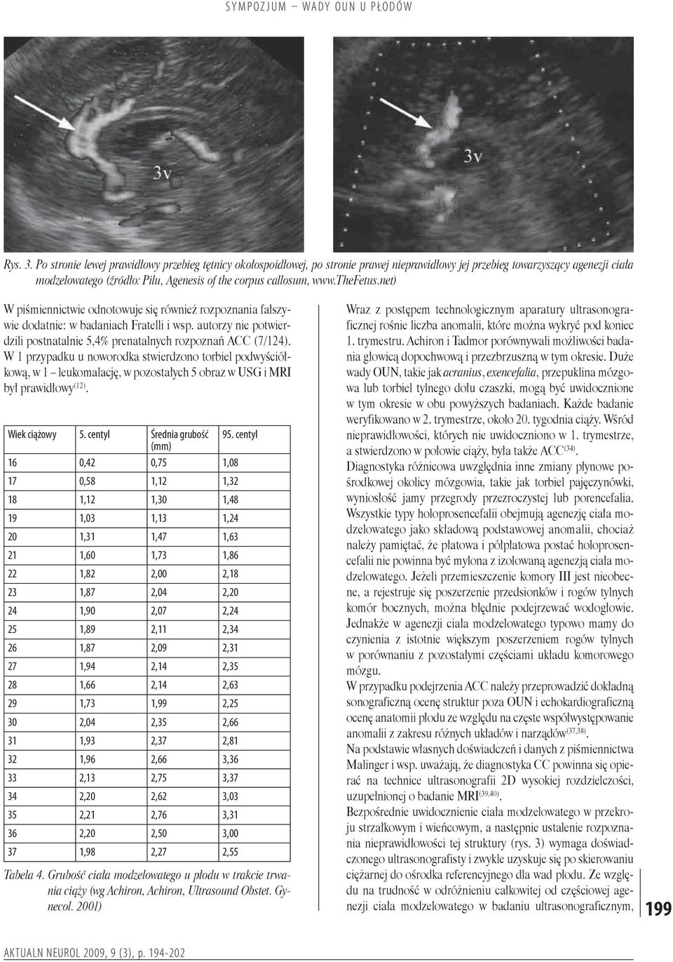 www.thefetus.net) W piśmiennictwie odnotowuje się również rozpoznania fałszywie dodatnie: w badaniach Fratelli i wsp. autorzy nie potwierdzili postnatalnie 5,4% prenatalnych rozpoznań ACC (7/124).