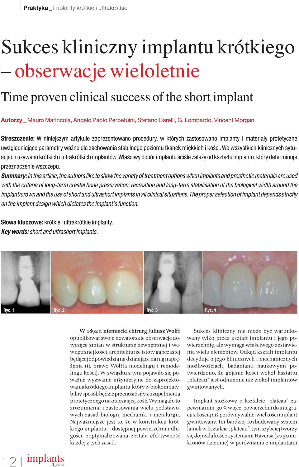 Lombardo, Vincent Morgan Streszczenie: W niniejszym artykule zaprezentowano procedury, w których zastosowano implanty i materiały protetyczne uwzgl dniajàce parametry wa ne dla zachowania stabilnego