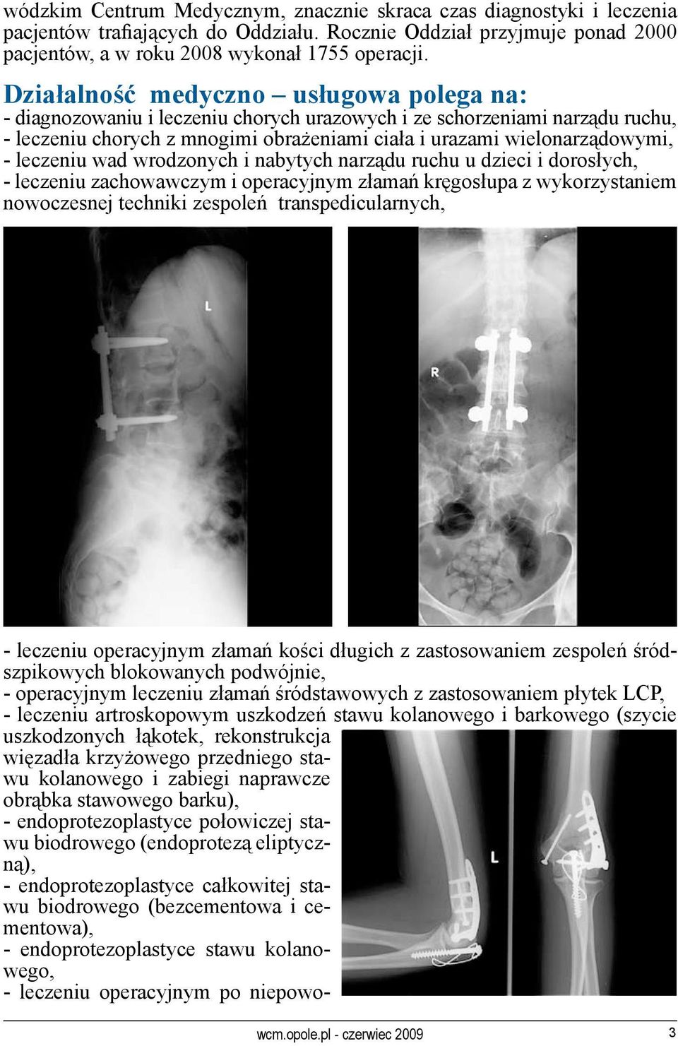 leczeniu wad wrodzonych i nabytych narządu ruchu u dzieci i dorosłych, - leczeniu zachowawczym i operacyjnym złamań kręgosłupa z wykorzystaniem nowoczesnej techniki zespoleń transpedicularnych, -