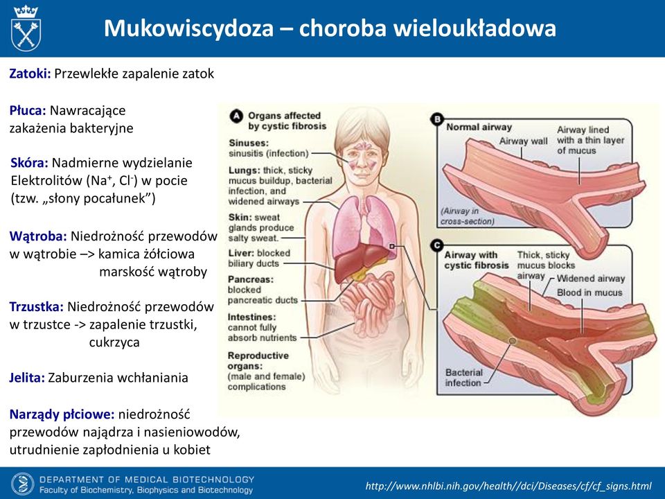 słony pocałunek ) Wątroba: Niedrożność przewodów w wątrobie > kamica żółciowa marskość wątroby Trzustka: Niedrożność przewodów w