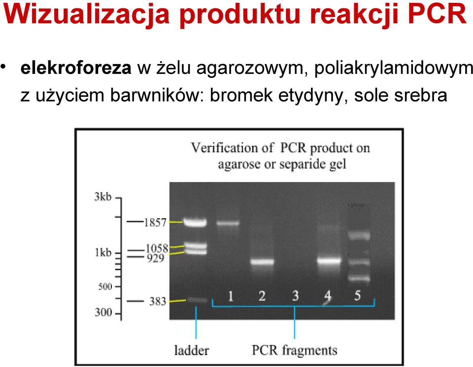 agarozowym, poliakrylamidowym z