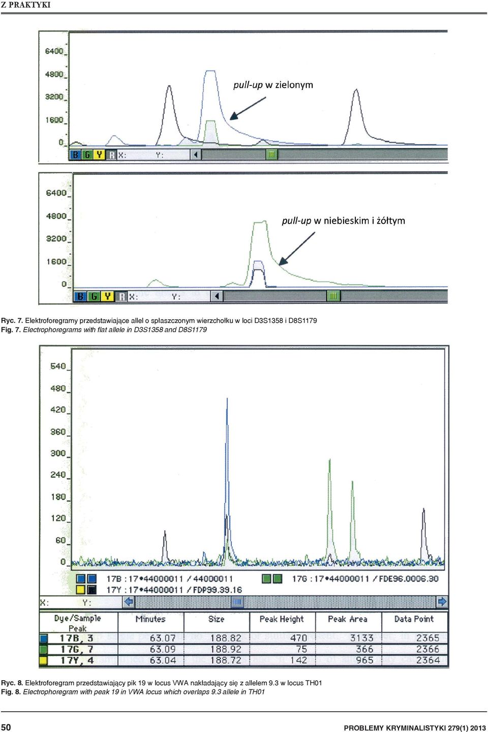 Electrophoregrams with flat allele in D3S1358 and D8S1179 Ryc. 8.