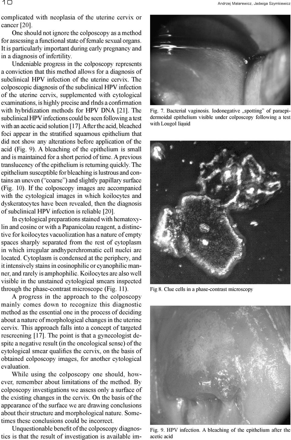 Undeniable progress in the colposcopy represents a conviction that this method allows for a diagnosis of subclinical HPV infection of the uterine cervix.