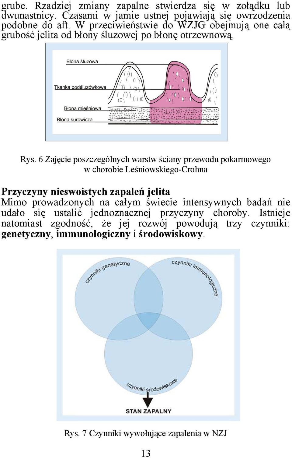 6 Zajęcie poszczególnych warstw ściany przewodu pokarmowego w chorobie Leśniowskiego-Crohna Przyczyny nieswoistych zapaleń jelita Mimo prowadzonych na całym