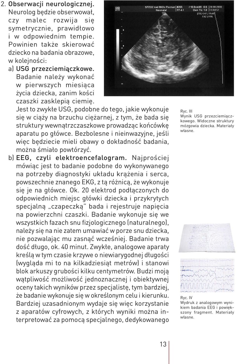 Jest to zwykłe USG, podobne do tego, jakie wykonuje się w ciąży na brzuchu ciężarnej, z tym, że bada się struktury wewnątrzczaszkowe prowadząc końcówkę aparatu po główce.