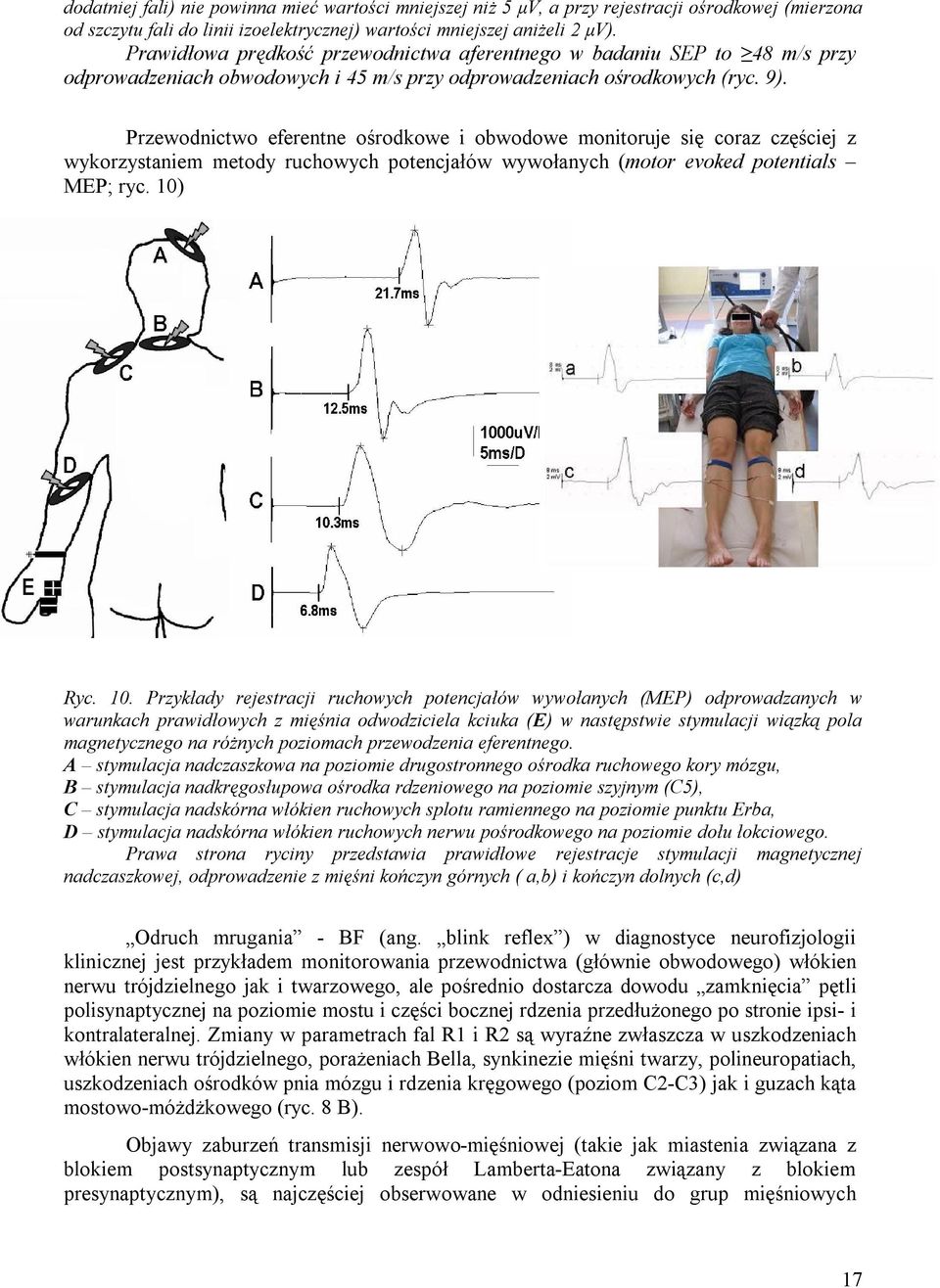Przewodnictwo eferentne ośrodkowe i obwodowe monitoruje się coraz częściej z wykorzystaniem metody ruchowych potencjałów wywołanych (motor evoked potentials MEP; ryc. 10)