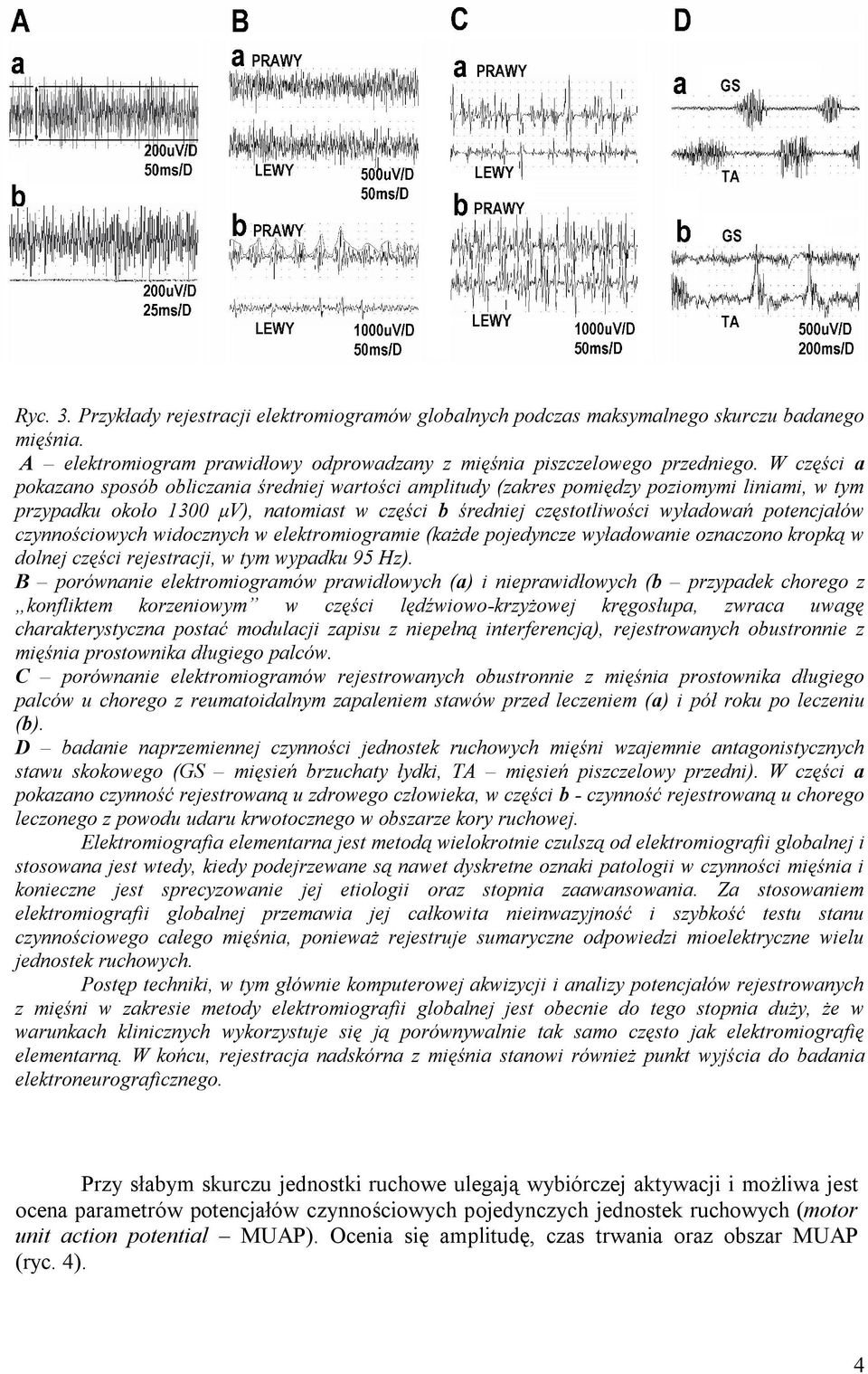 potencjałów czynnościowych widocznych w elektromiogramie (każde pojedyncze wyładowanie oznaczono kropką w dolnej części rejestracji, w tym wypadku 95 Hz).