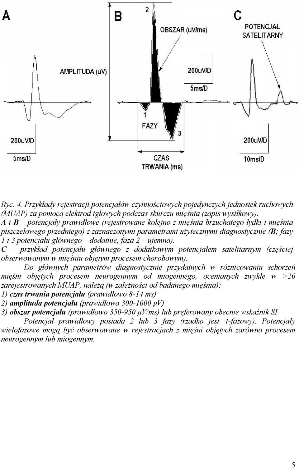 głównego dodatnie, faza 2 ujemna). C przykład potencjału głównego z dodatkowym potencjałem satelitarnym (częściej obserwowanym w mięśniu objętym procesem chorobowym).
