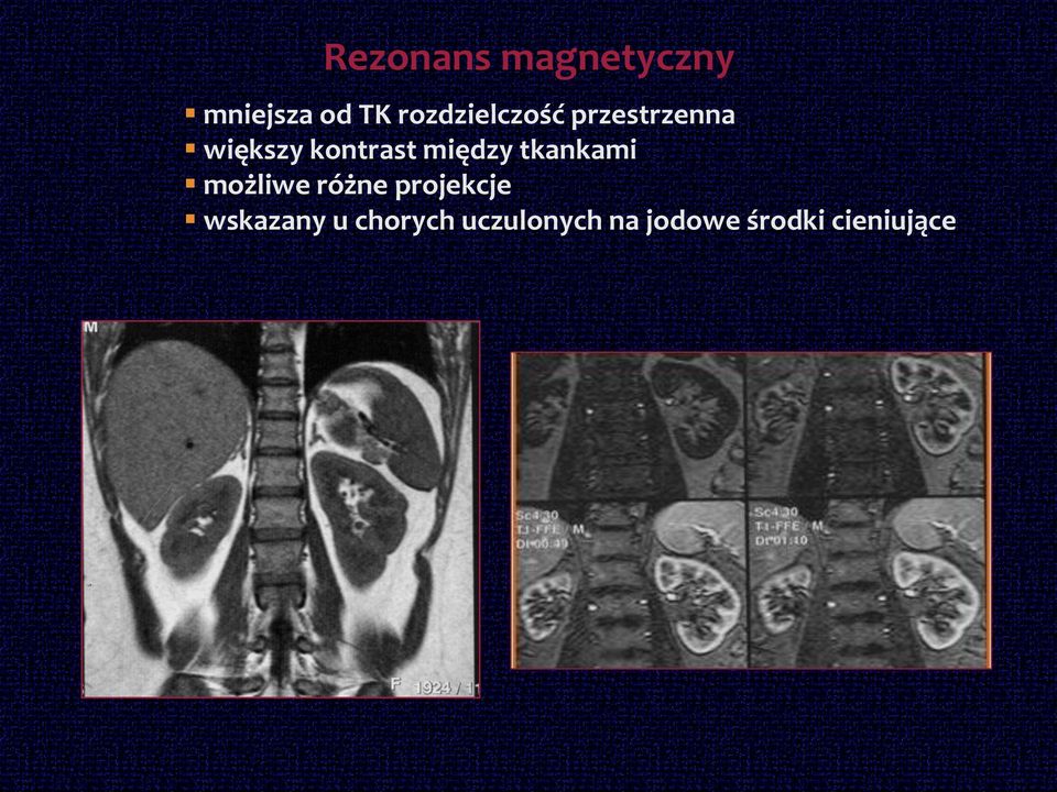 między tkankami możliwe różne projekcje