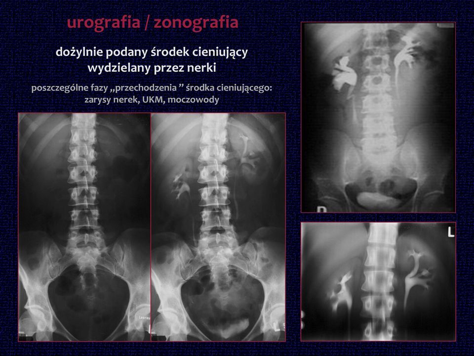 poszczególne fazy przechodzenia środka