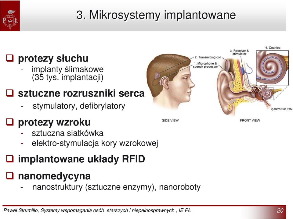 protezy wzroku - sztuczna siatkówka - elektro-stymulacja kory wzrokowej