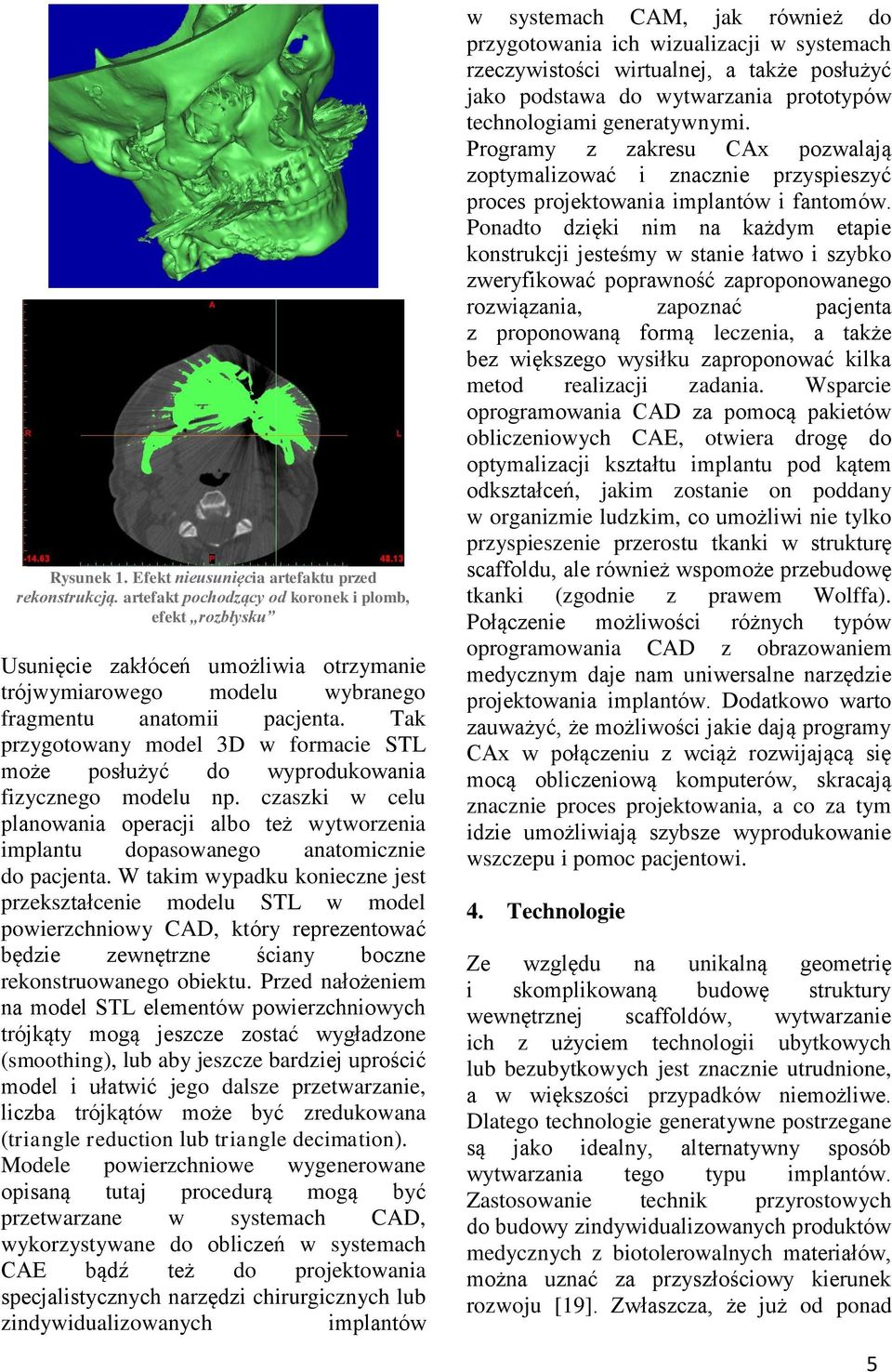 Tak przygotowany model 3D w formacie STL może posłużyć do wyprodukowania fizycznego modelu np. czaszki w celu planowania operacji albo też wytworzenia implantu dopasowanego anatomicznie do pacjenta.