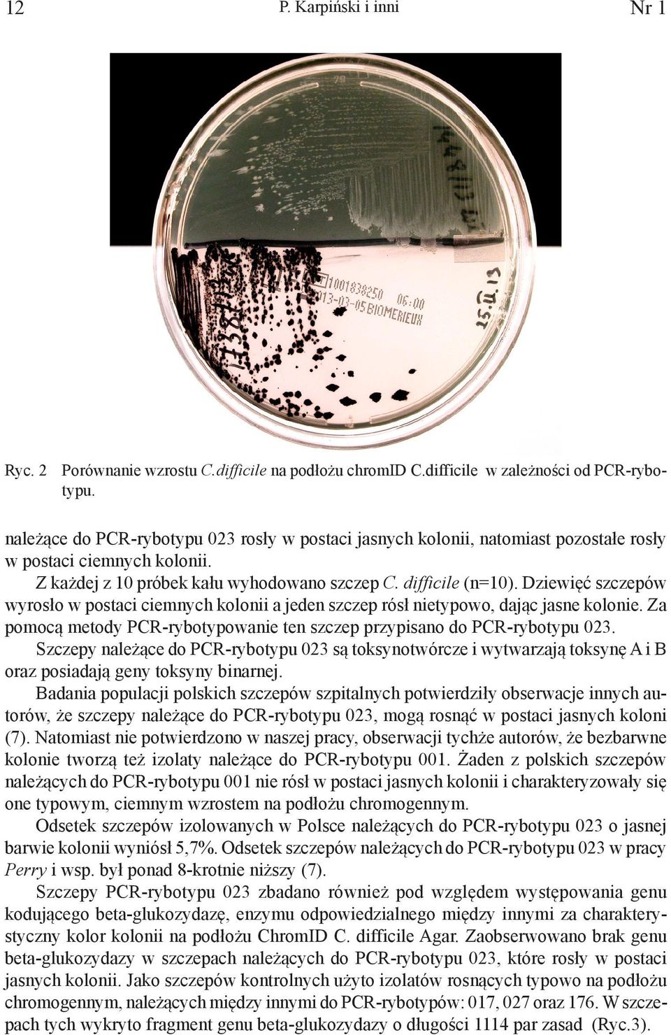 Dziewięć szczepów wyrosło w postaci ciemnych kolonii a jeden szczep rósł nietypowo, dając jasne kolonie. Za pomocą metody PCR-rybotypowanie ten szczep przypisano do PCR-rybotypu 023.