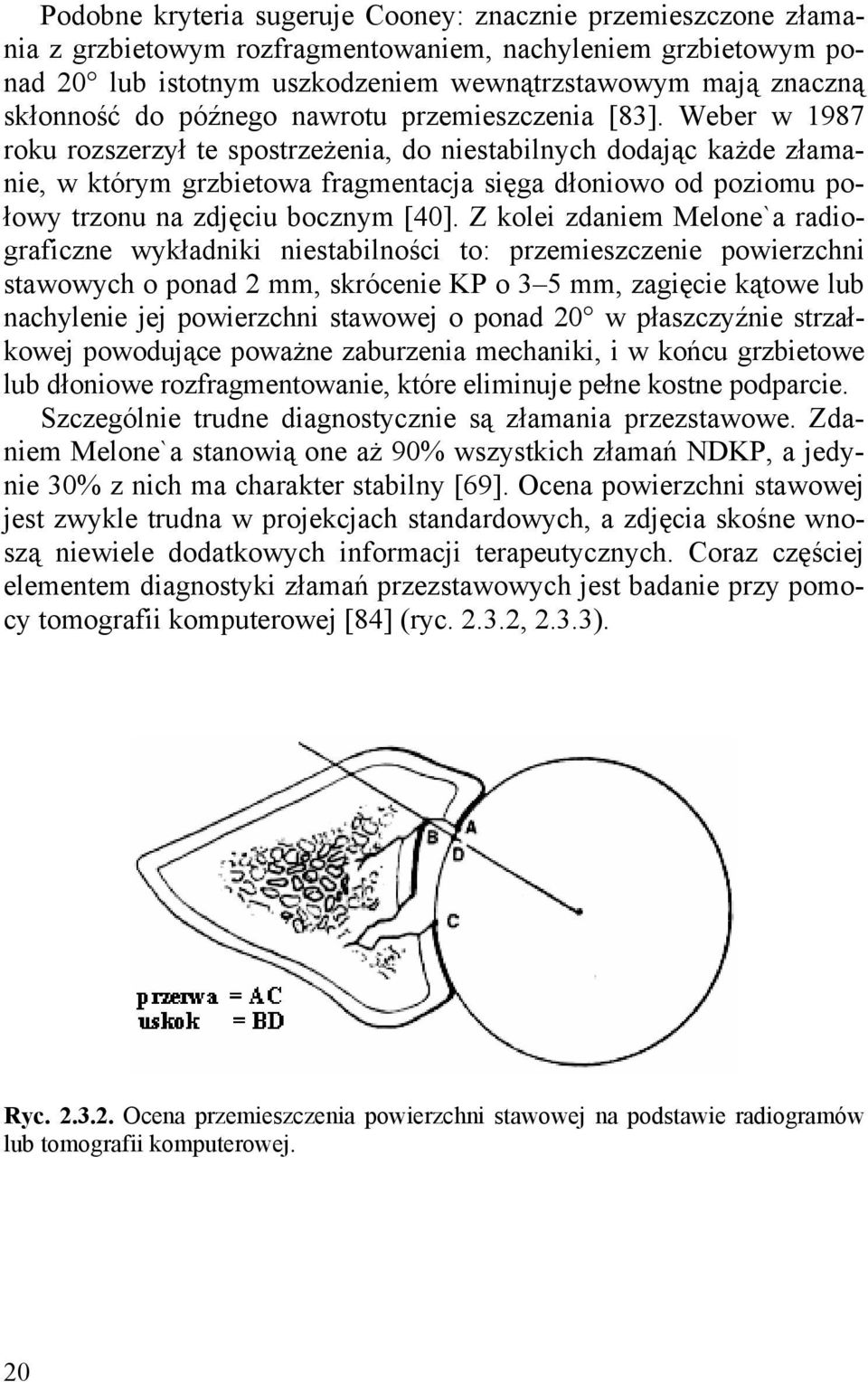 Weber w 1987 roku rozszerzył te spostrzeżenia, do niestabilnych dodając każde złamanie, w którym grzbietowa fragmentacja sięga dłoniowo od poziomu połowy trzonu na zdjęciu bocznym [40].