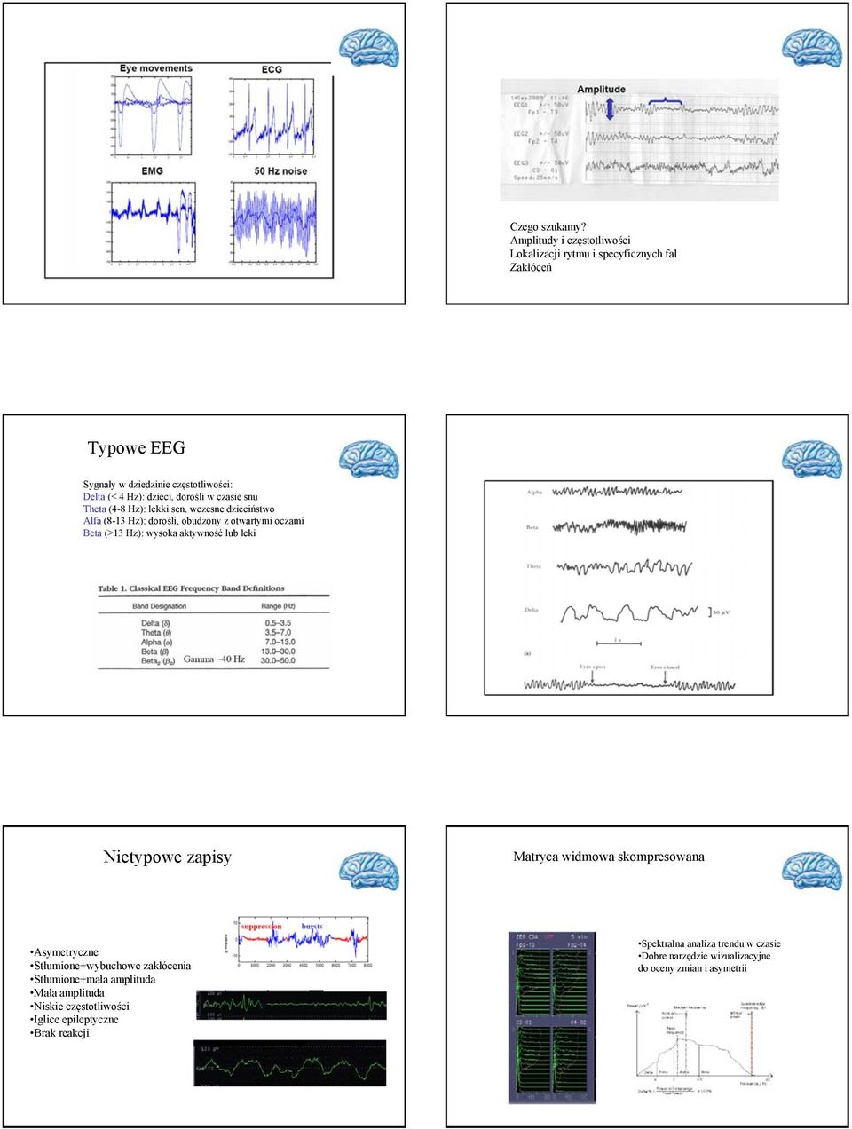 dorośli w czasie snu Theta (4-8 Hz): lekki sen, wczesne dzieciństwo Alfa (8-13 Hz): dorośli, obudzony z otwartymi oczami Beta (>13 Hz): wysoka