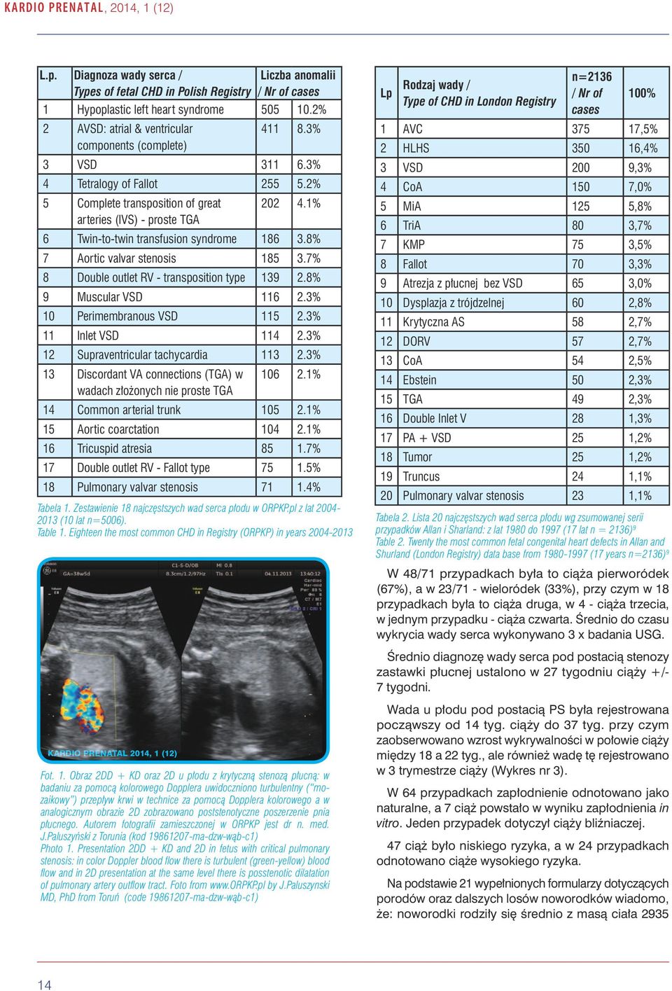 1% 6 Twin-to-twin transfusion syndrome 186 3.8% 7 Aortic valvar stenosis 185 3.7% 8 Double outlet RV - transposition type 139 2.8% 9 Muscular VSD 116 2.3% 10 Perimembranous VSD 115 2.