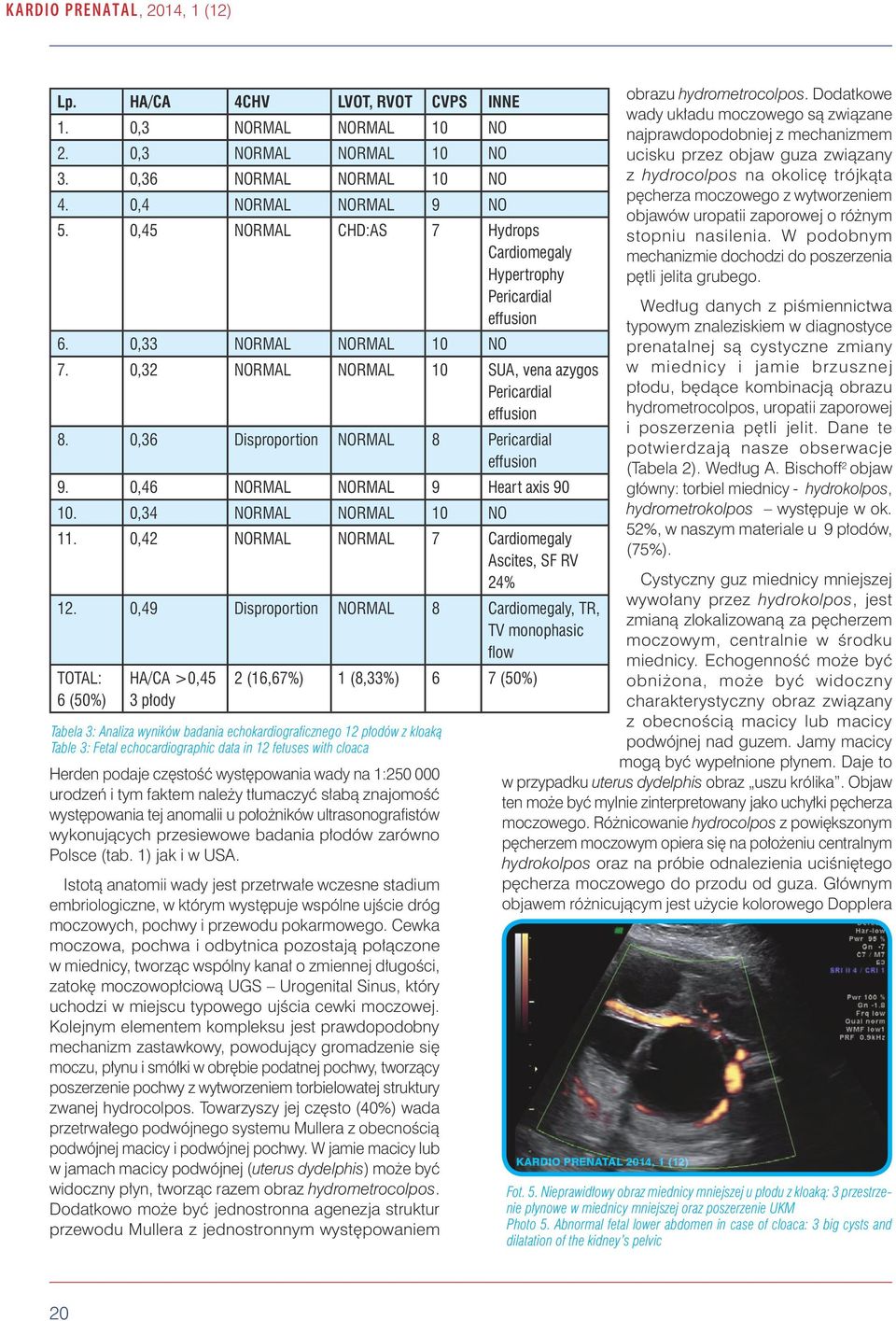 0,36 Disproportion NORMAL 8 Pericardial effusion 9. 0,46 NORMAL NORMAL 9 Heart axis 90 10. 0,34 NORMAL NORMAL 10 NO 11. 0,42 NORMAL NORMAL 7 Cardiomegaly Ascites, SF RV 24% 12.