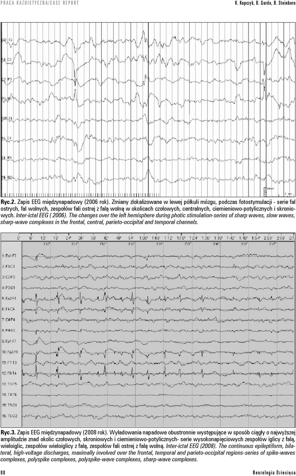 skroniowych. Inter-ictal EEG ( 2006).