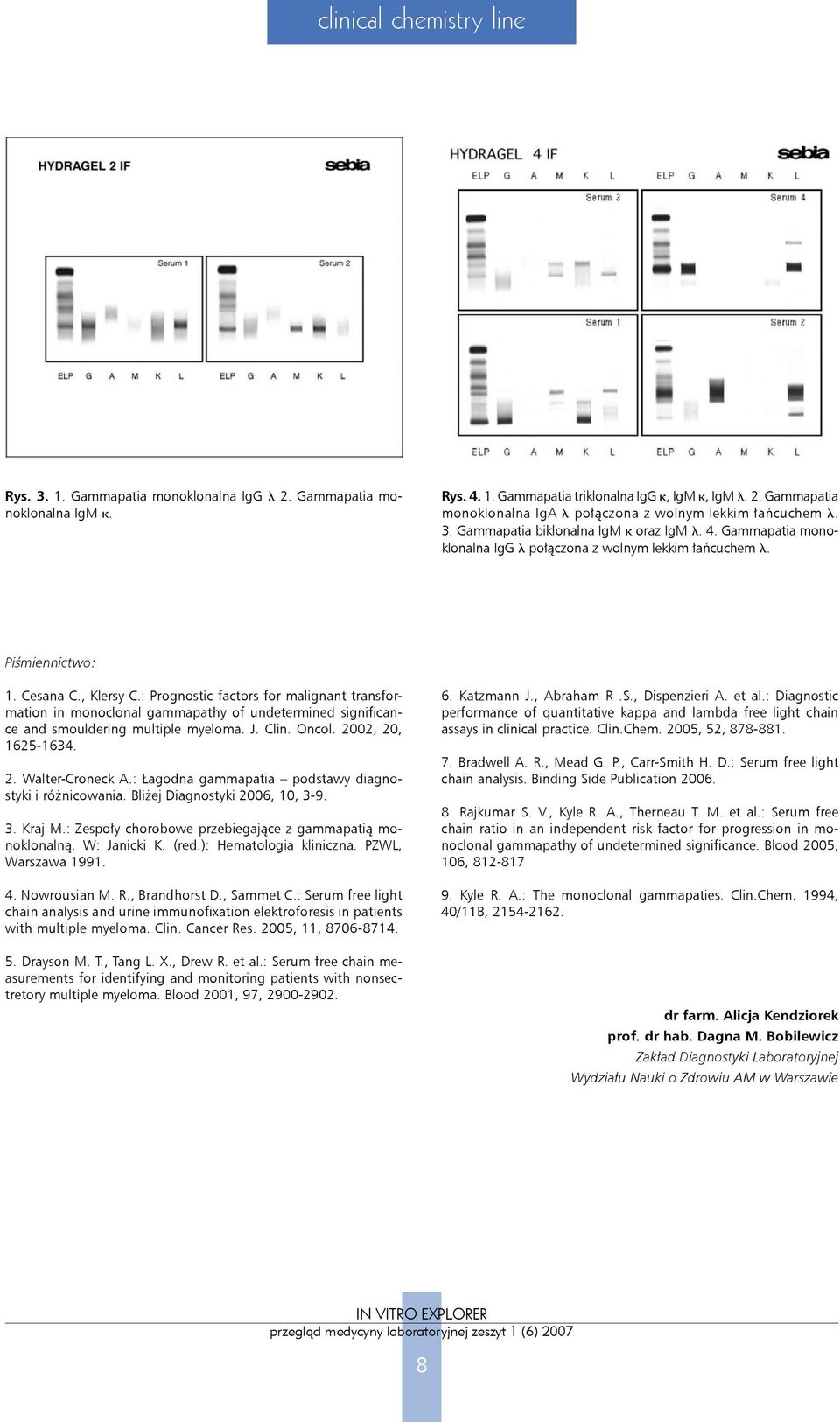 : Prognostic factors for malignant transformation in monoclonal gammapathy of undetermined significance and smouldering multiple myeloma. J. Clin. Oncol. 2002, 20, 1625-1634. 2. Walter-Croneck A.