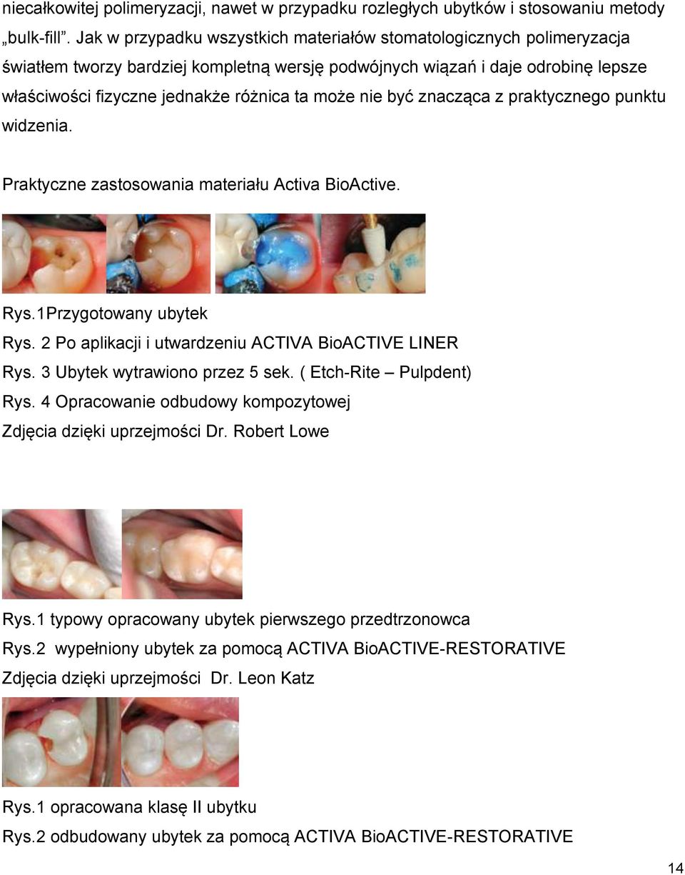 nie być znacząca z praktycznego punktu widzenia. Praktyczne zastosowania materiału Activa BioActive. Rys.1 Przygotowany ubytek Rys. 2 Po aplikacji i utwardzeniu ACTIVA BioACTIVE LINER Rys.