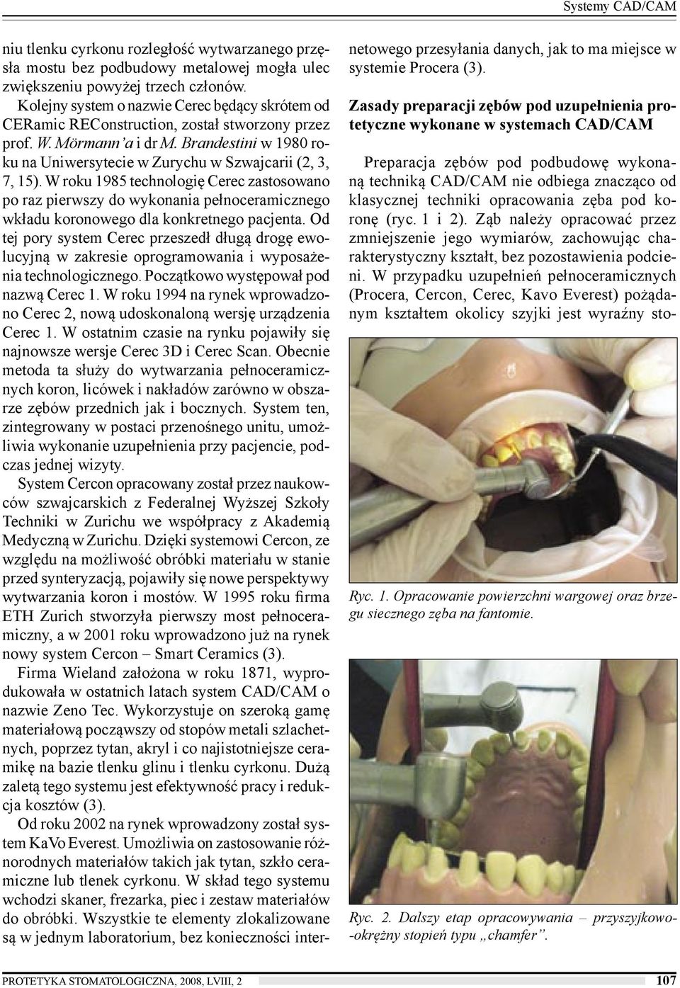 W roku 1985 technologię Cerec zastosowano po raz pierwszy do wykonania pełnoceramicznego wkładu koronowego dla konkretnego pacjenta.