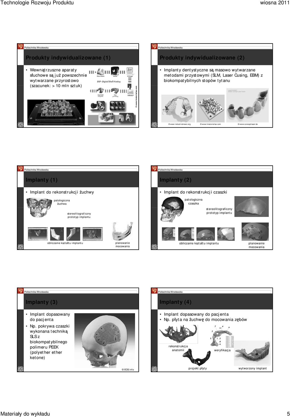 com www conceptlaser de Implanty (1) Implant do rekonstrukcji żuchwy Implanty (2) Implant do rekonstrukcji czaszki patologiczna żuchwa stereolitograficzny prototyp implantu patologiczna czaszka