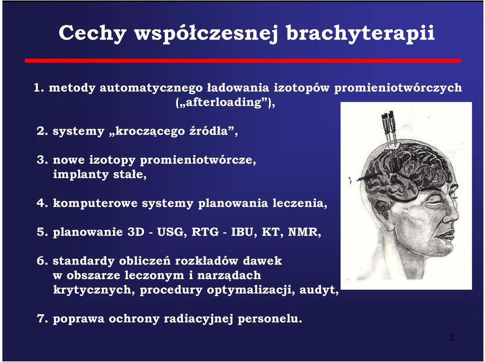 systemy y kroczącego ą źródła,, 3. nowe izotopy promieniotwórcze, implanty stałe, 4.