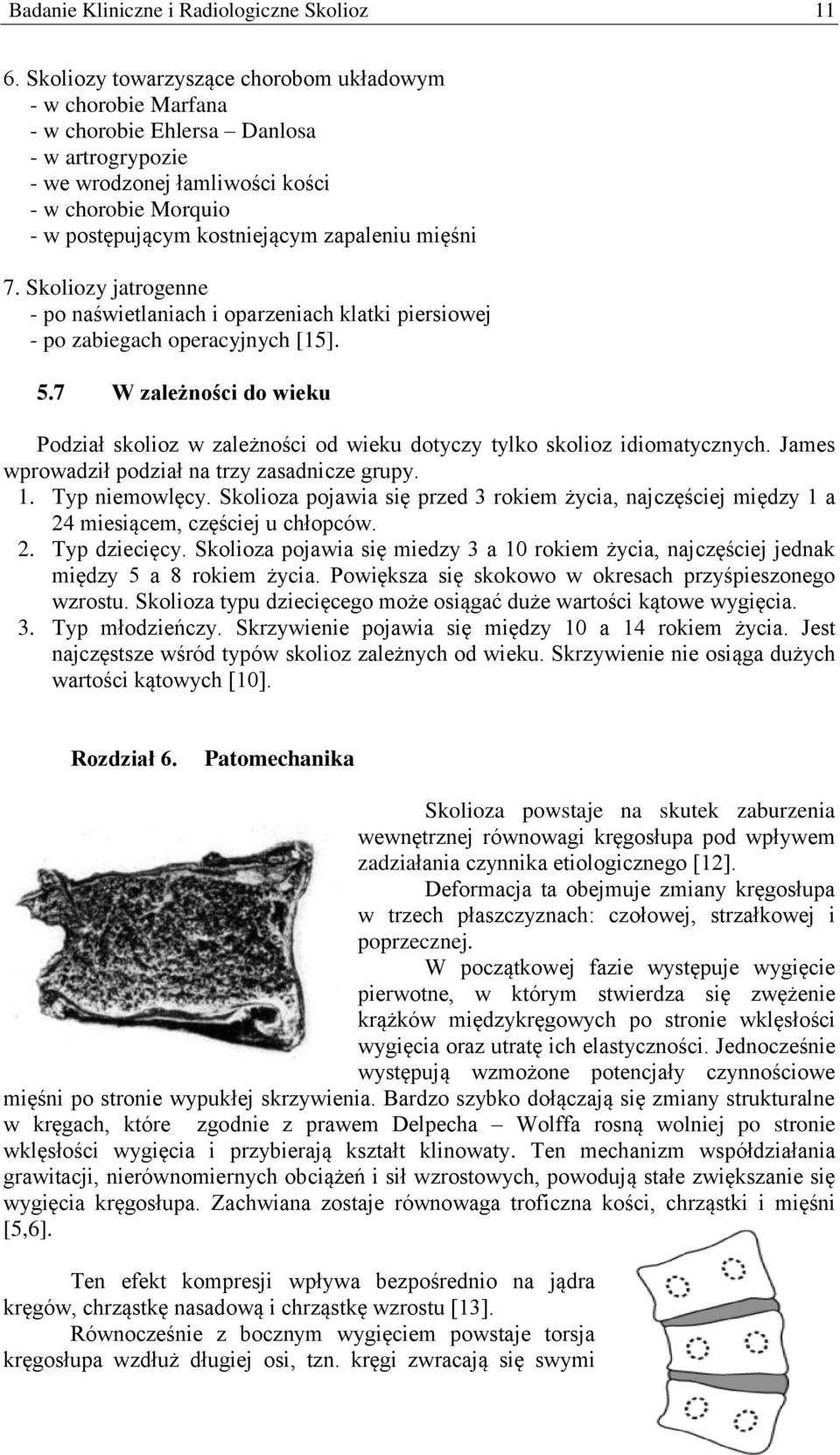 zapaleniu mięśni 7. Skoliozy jatrogenne - po naświetlaniach i oparzeniach klatki piersiowej - po zabiegach operacyjnych [15]. 5.