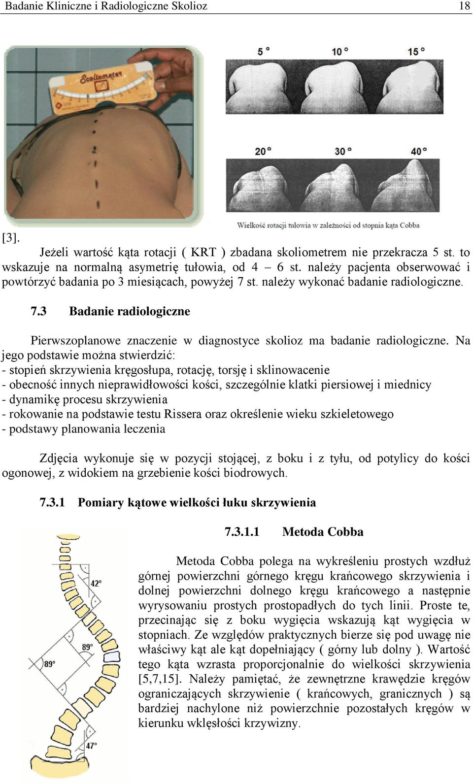 Na jego podstawie można stwierdzić: - stopień skrzywienia kręgosłupa, rotację, torsję i sklinowacenie - obecność innych nieprawidłowości kości, szczególnie klatki piersiowej i miednicy - dynamikę