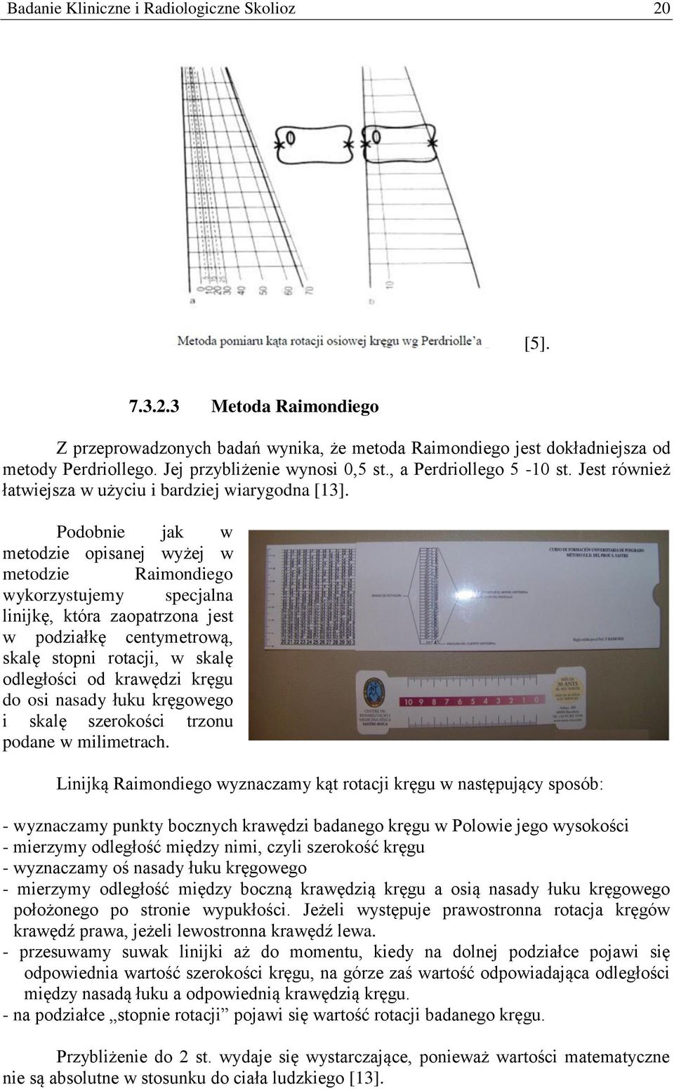 Podobnie jak w metodzie opisanej wyżej w metodzie Raimondiego wykorzystujemy specjalna linijkę, która zaopatrzona jest w podziałkę centymetrową, skalę stopni rotacji, w skalę odległości od krawędzi