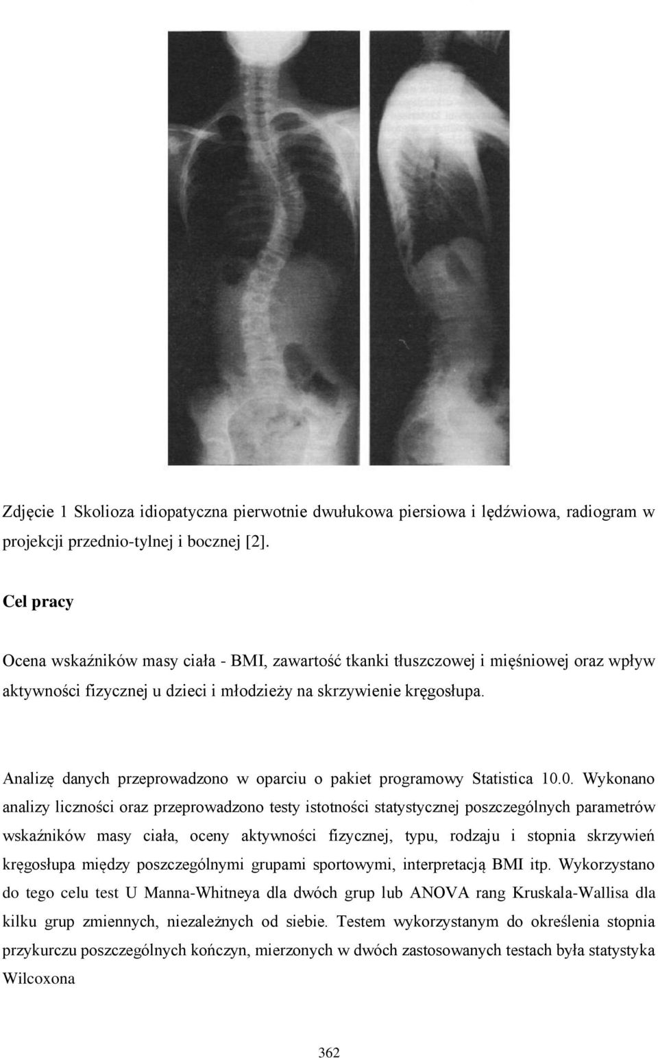 Analizę danych przeprowadzono w oparciu o pakiet programowy Statistica 10.