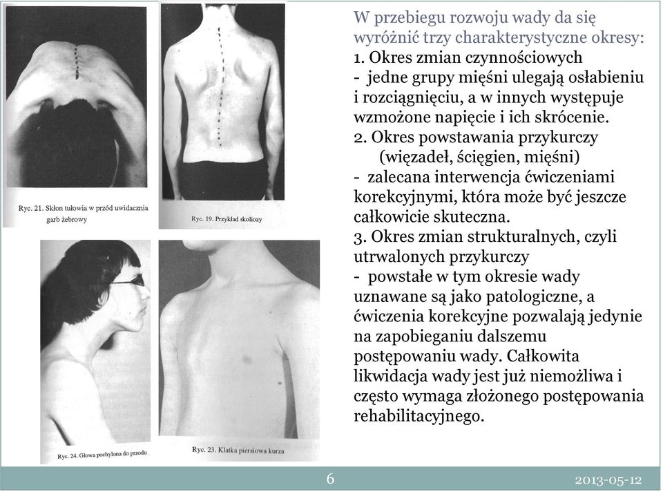 Okres powstawania przykurczy (więzadeł, ścięgien, mięśni) - zalecana interwencja ćwiczeniami korekcyjnymi, która może być jeszcze całkowicie skuteczna. 3.