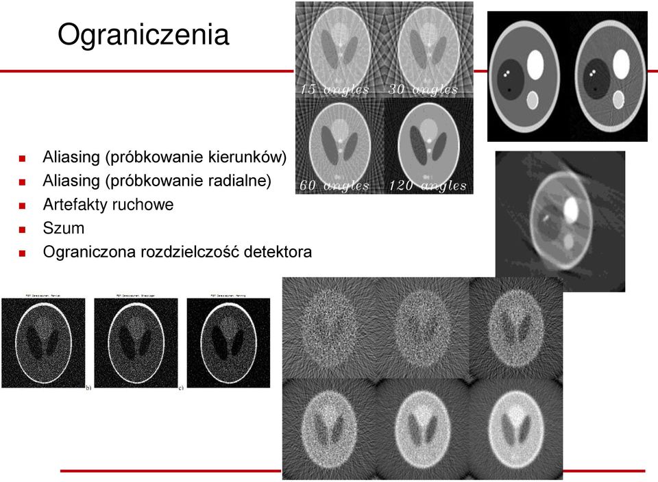 (próbkowanie radialne) Artefakty