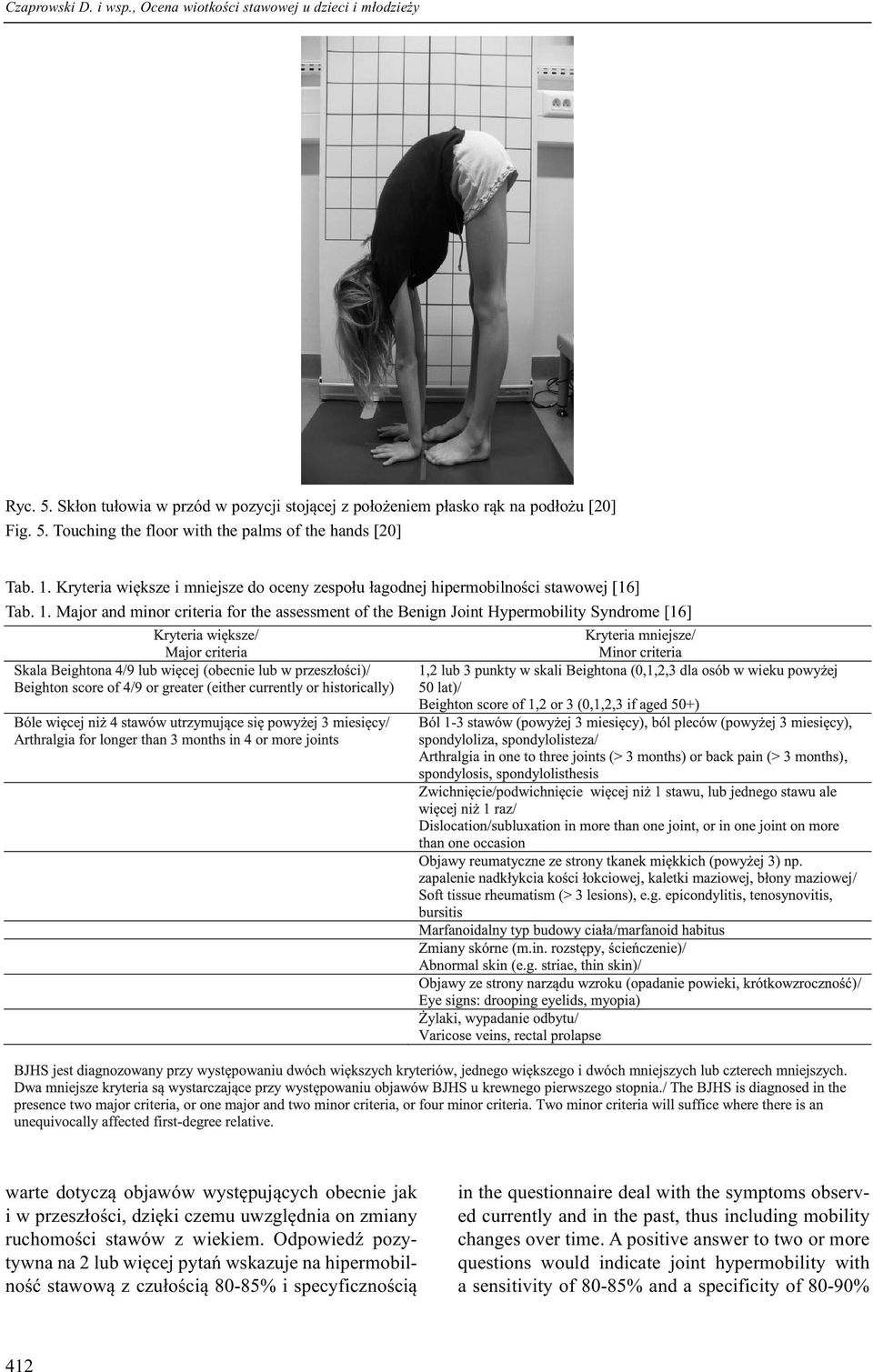 Major and minor criteria for the assessment of the Benign Joint Hypermobility Syndrome [16] warte dotyczą objawów występujących obecnie jak i w przeszłości, dzięki czemu uwzględnia on zmiany