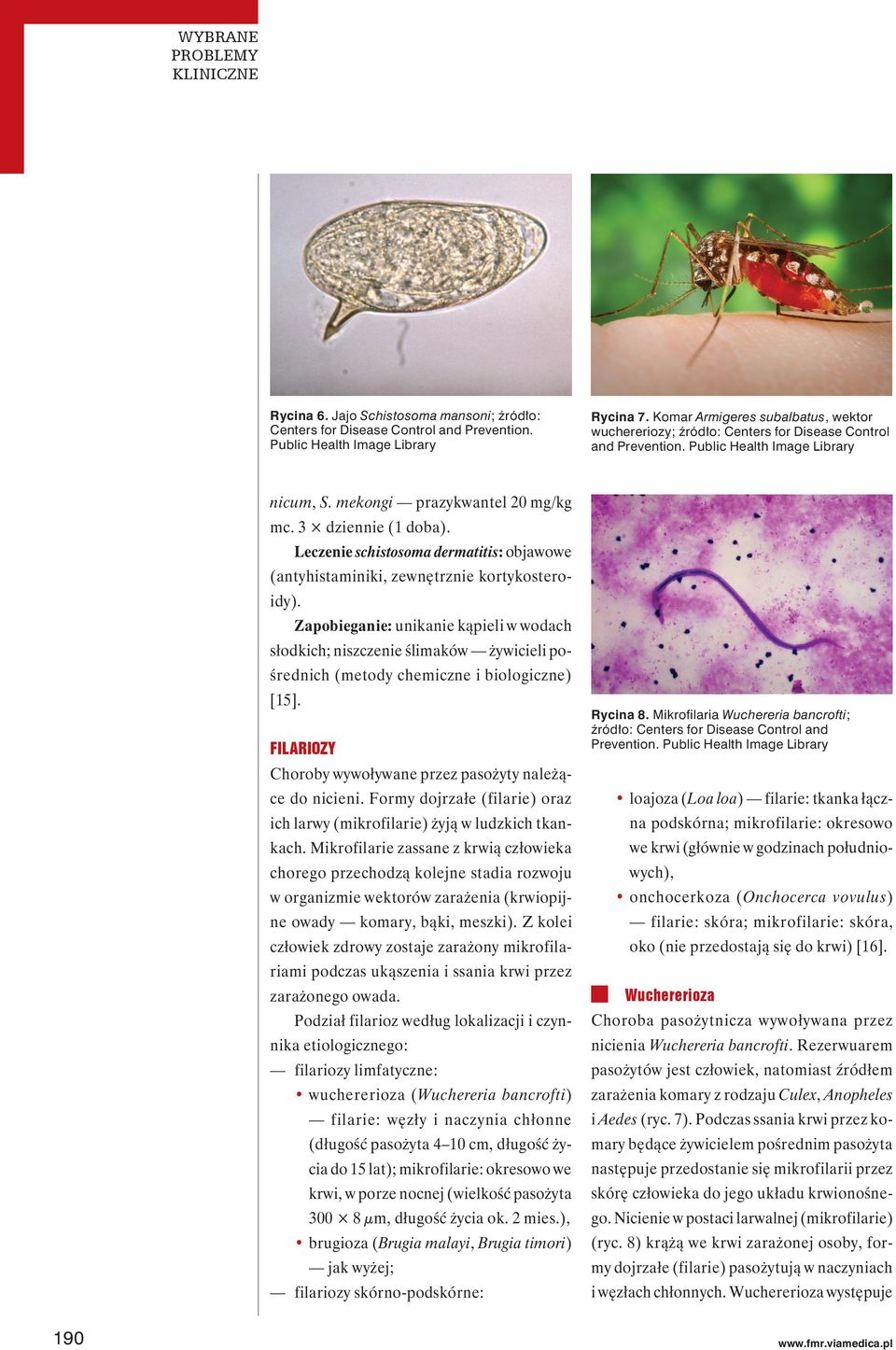 Leczenie schistosoma dermatitis: objawowe (antyhistaminiki, zewnętrznie kortykosteroidy).