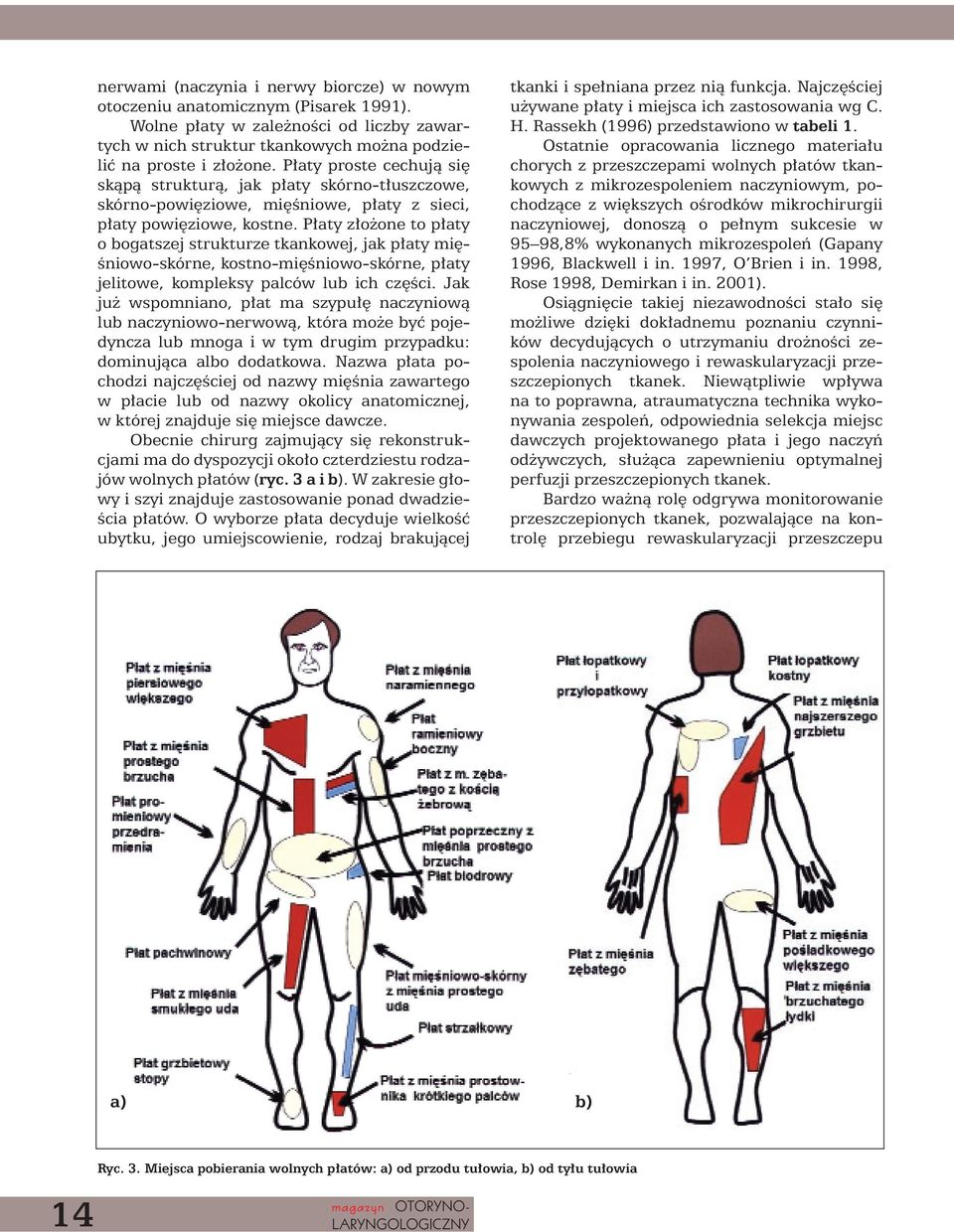 P aty z o one to p aty o bogatszej strukturze tkankowej, jak p aty mi - Êniowo-skórne, kostno-mi Êniowo-skórne, p aty jelitowe, kompleksy palców lub ich cz Êci.