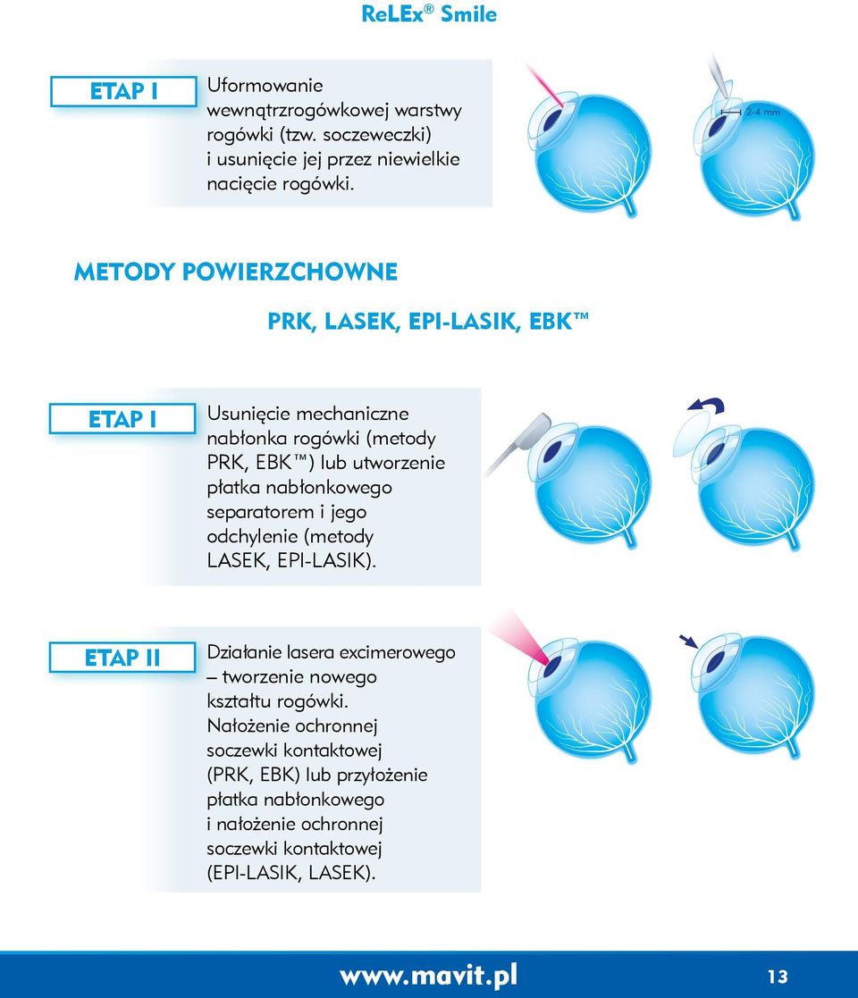 nabłonkowego separatorem i jego odchylenie (metody LASEK, EPI-LASIK). ETAP II Działanie lasera excimerowego tworzenie nowego kształtu rogówki.