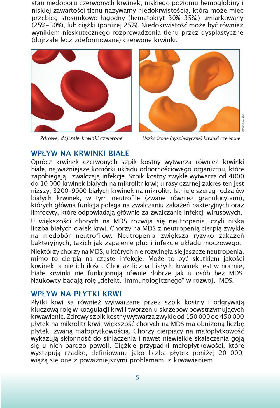 2008 Kirk Moldoff Zdrowe, dojrzałe krwinki czerwone Uszkodzone (dysplastyczne) krwinki czerwone WPŁYW NA KRWINKI BIAŁE Oprócz krwinek czerwonych szpik kostny wytwarza również krwinki białe,