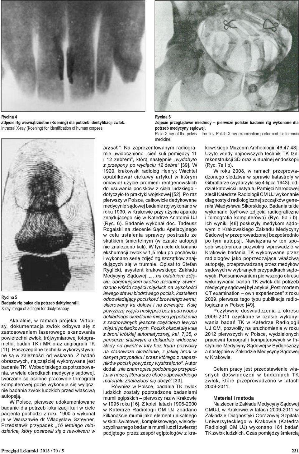 Aktualnie, w ramach projektu Virtopsy, dokumentacja zwłok odbywa się z zastosowaniem laserowego skanowania powierzchni zwłok, trójwymiarowej fotogrametrii, badań TK i MR oraz angiografii TK [11].