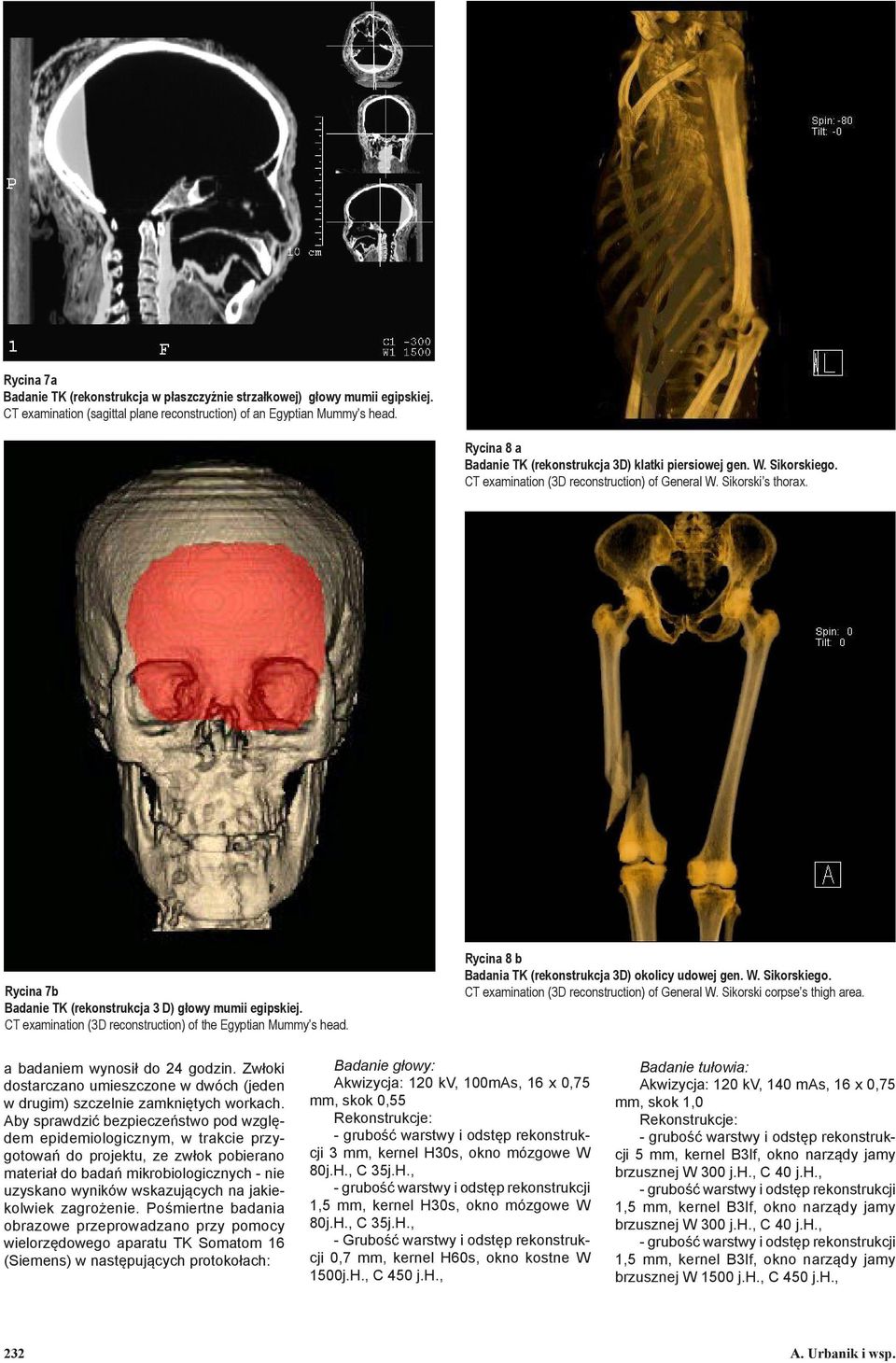 Rycina 7b Badanie TK (rekonstrukcja 3 D) głowy mumii egipskiej. CT examination (3D reconstruction) of the Egyptian Mummy s head. Rycina 8 b Badania TK (rekonstrukcja 3D) okolicy udowej gen. W.