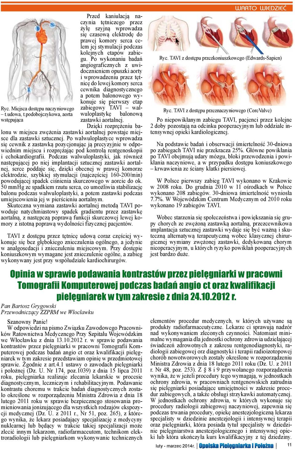 Po wykonaniu badań angiograficznych z uwidocznieniem opuszki aorty i wprowadzeniu przez tętnicę do lewej komory serca cewnika diagnostycznego a potem balonowego wykonuje się pierwszy etap zabiegowy