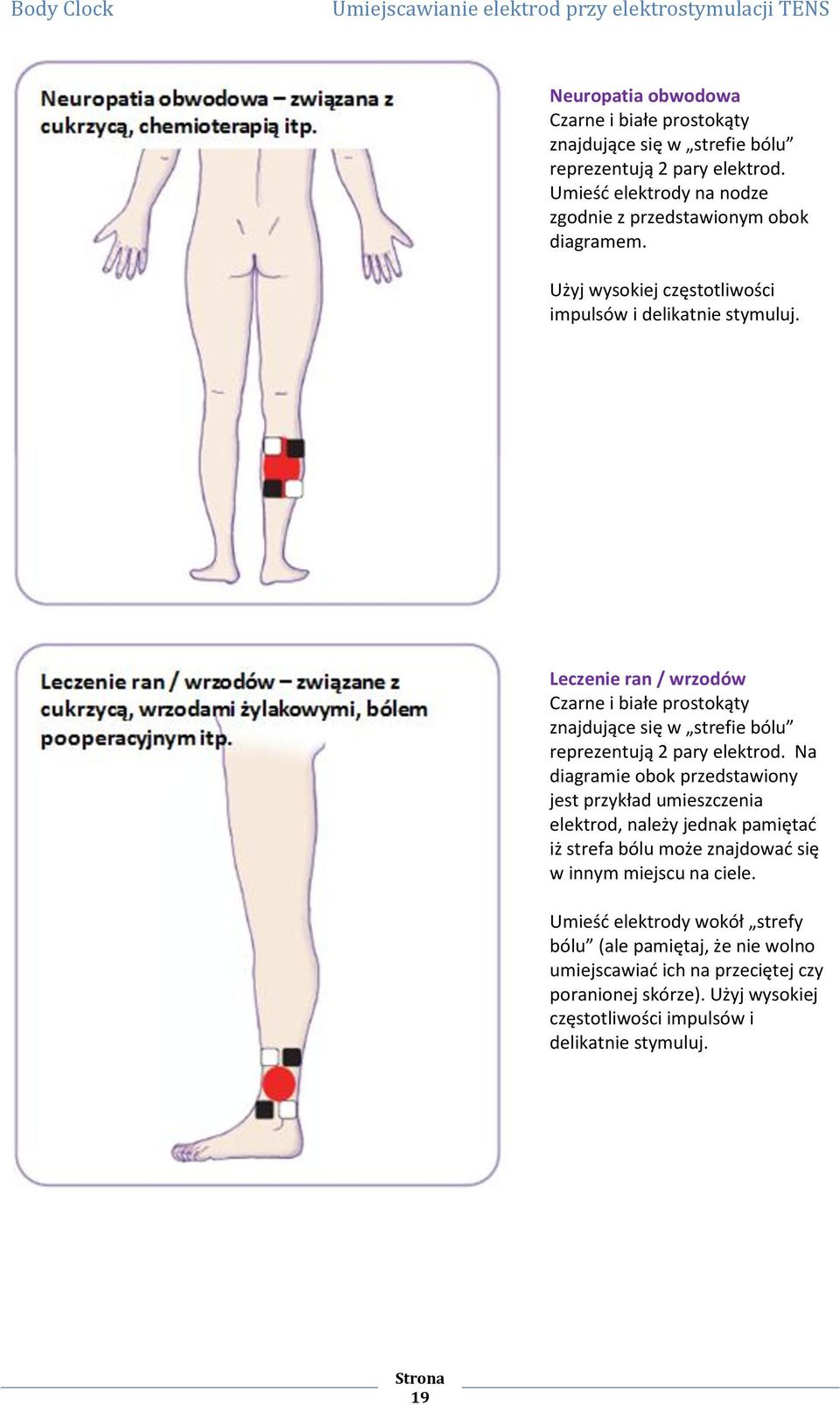 Leczenie ran / wrzodów Czarne i białe prostokąty znajdujące się w strefie bólu reprezentują 2 pary elektrod.