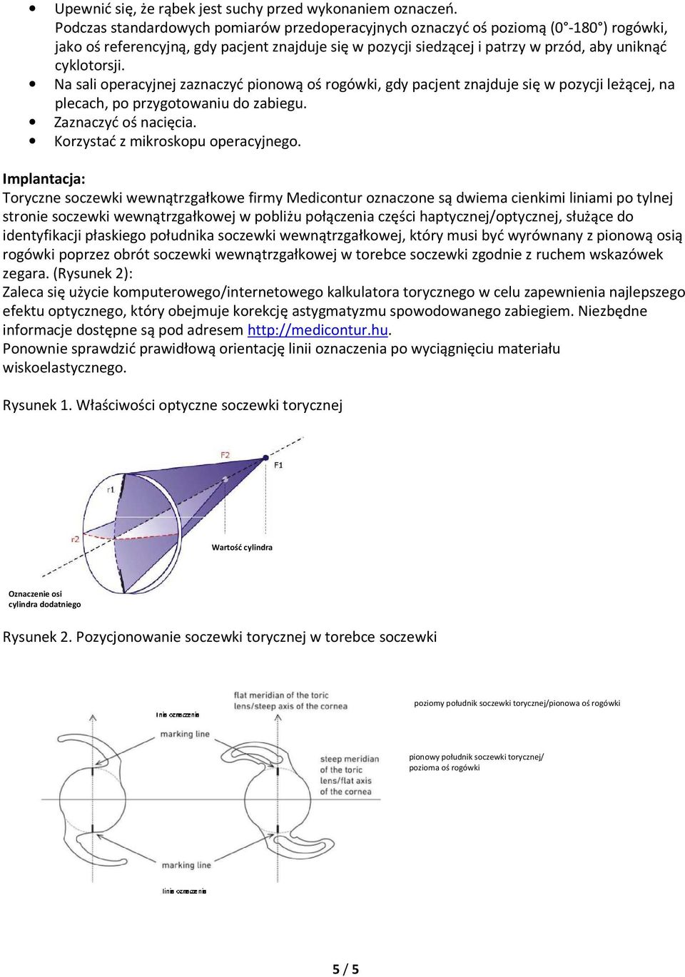 Na sali operacyjnej zaznaczyć pionową oś rogówki, gdy pacjent znajduje się w pozycji leżącej, na plecach, po przygotowaniu do zabiegu. Zaznaczyć oś nacięcia. Korzystać z mikroskopu operacyjnego.