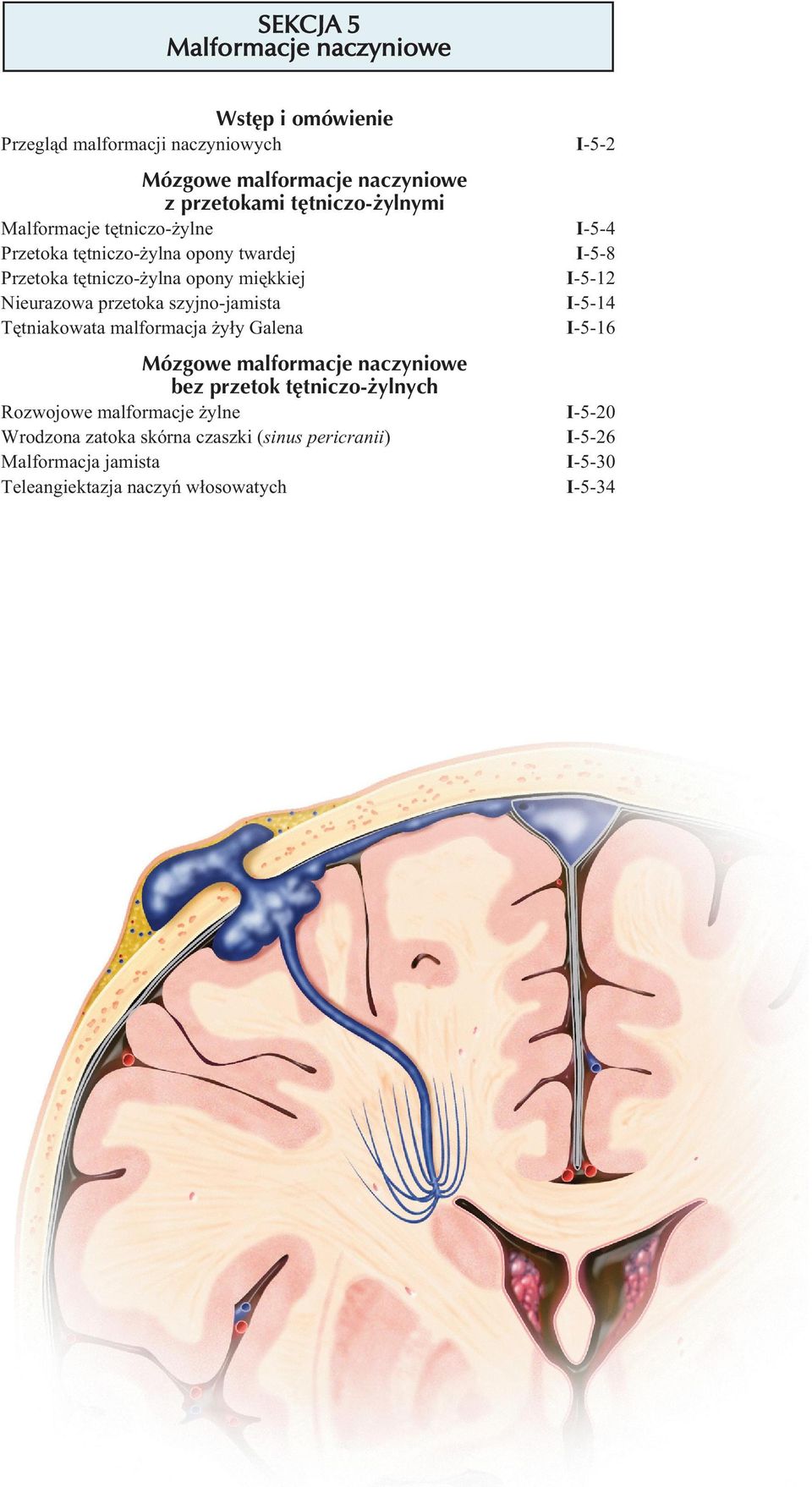 przetoka szyjno-jamista Tętniakowata malformacja żyły Galena Mózgowe malformacje naczyniowe bez przetok tętniczo-żylnych Rozwojowe