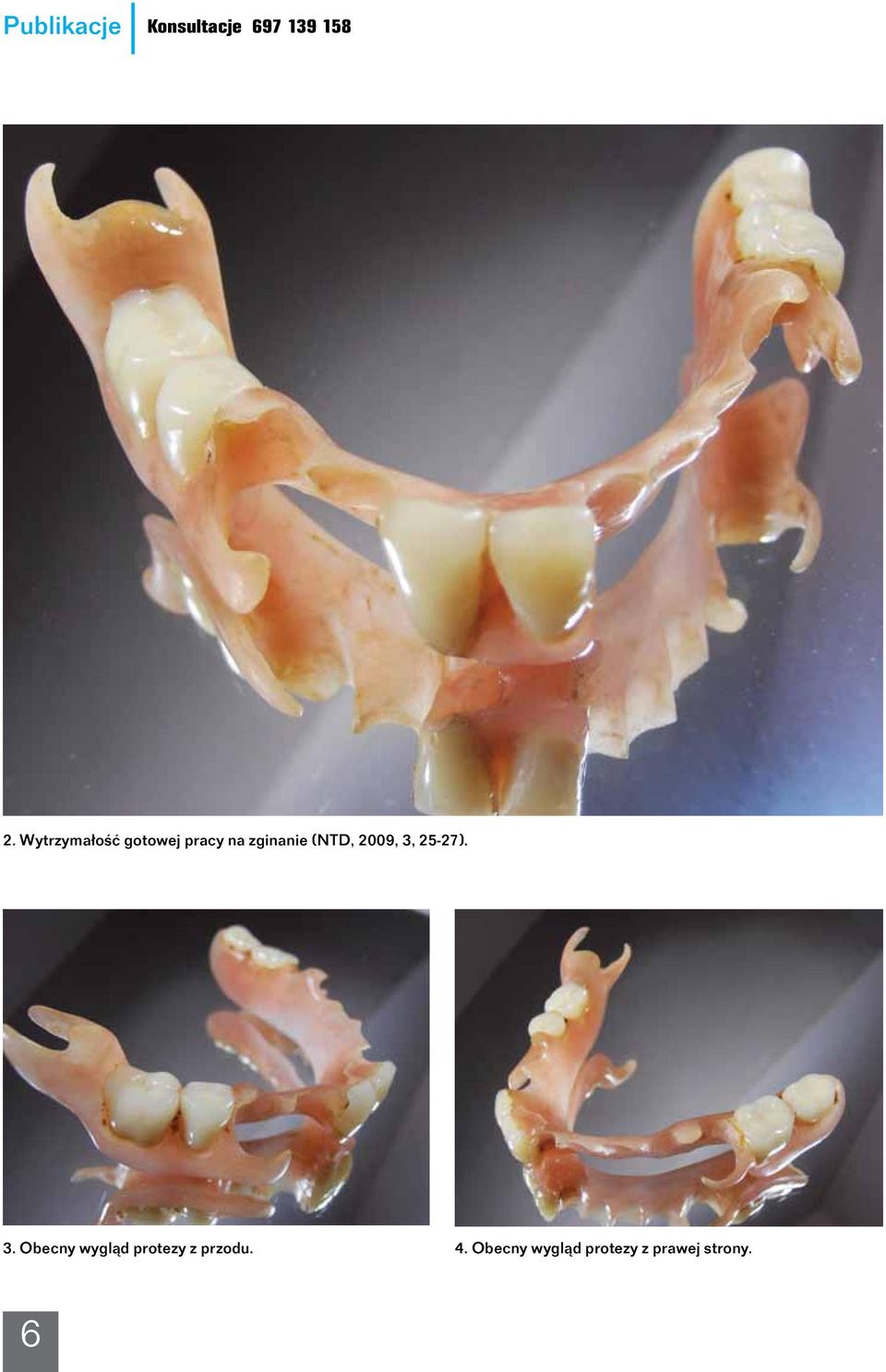 2009, 3, 25-27). 3. Obecny wygląd protezy z przodu.