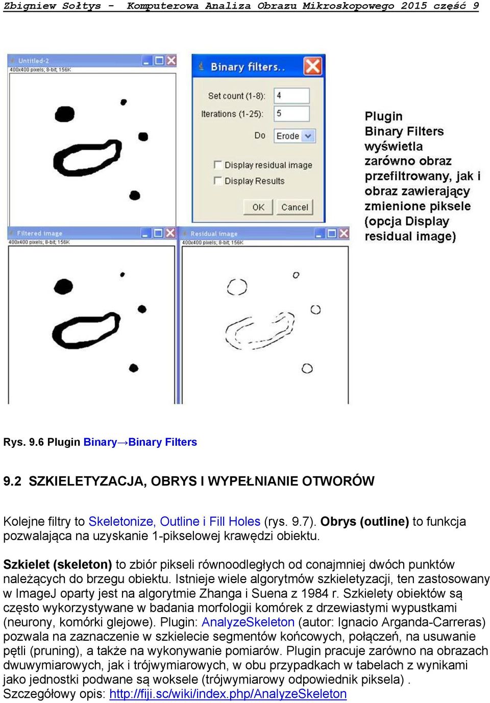 Istnieje wiele algorytmów szkieletyzacji, ten zastosowany w ImageJ oparty jest na algorytmie Zhanga i Suena z 1984 r.