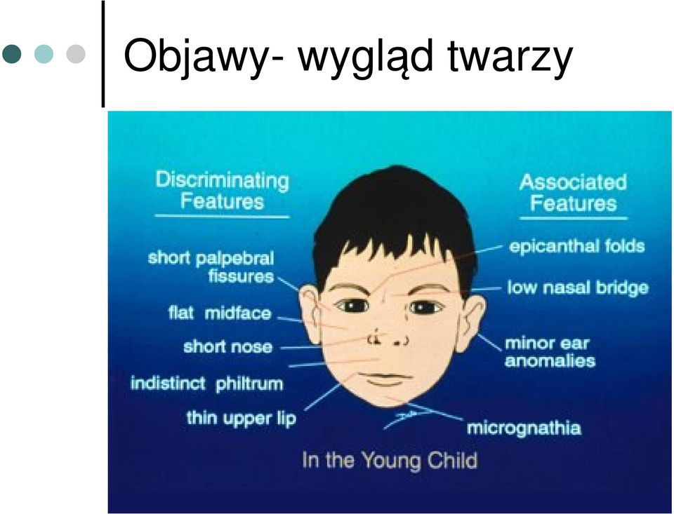 twarzy