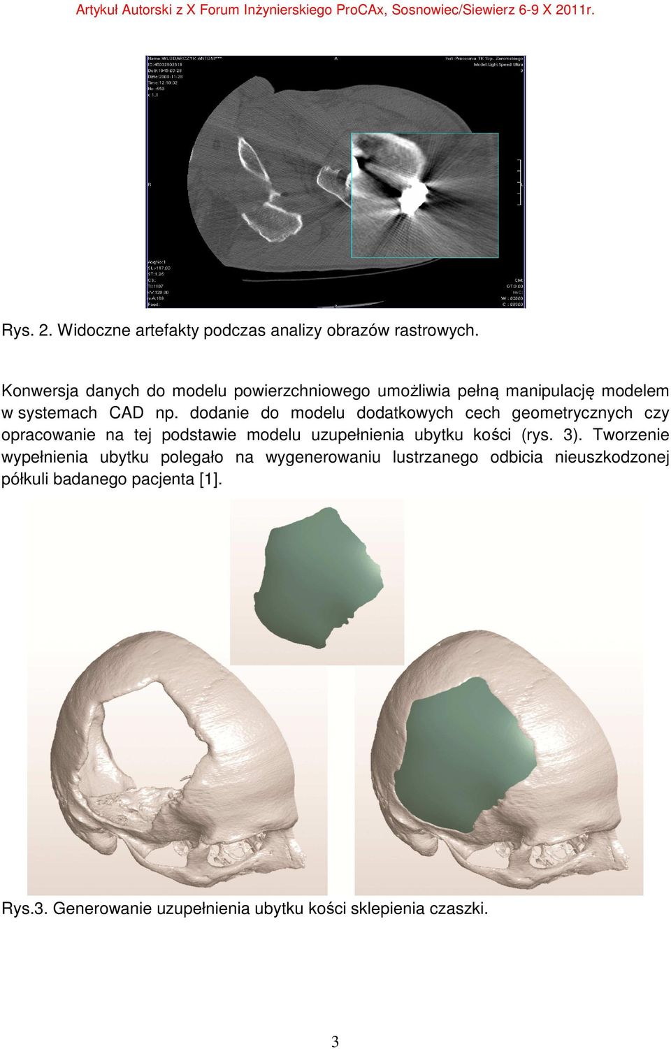 dodanie do modelu dodatkowych cech geometrycznych czy opracowanie na tej podstawie modelu uzupełnienia ubytku kości