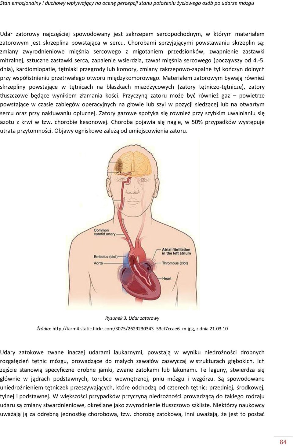 mięśnia sercowego (począwszy od 4.-. dnia), kardiomiopatie, tętniaki przegrody lub komory, zmiany zakrzepowo-zapalne żył kooczyn dolnych przy współistnieniu przetrwałego otworu międzykomorowego.