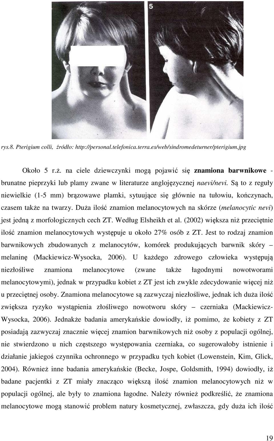 Są to z reguły niewielkie (1-5 mm) brązowawe plamki, sytuujące się głównie na tułowiu, kończynach, czasem także na twarzy.